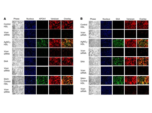 Immunofluorescence of Anti-Apolipoprotein AI